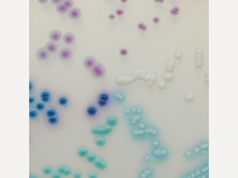 耳念珠菌培養基