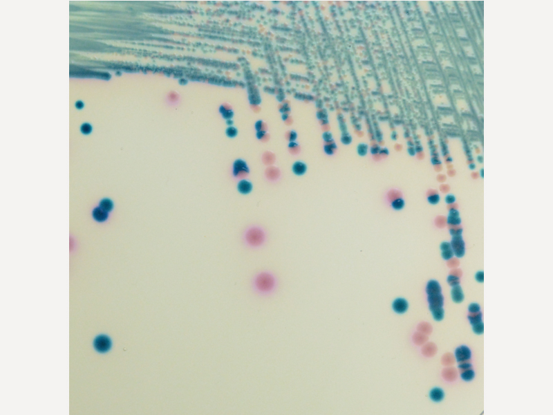 mSuperCARBA 培養基