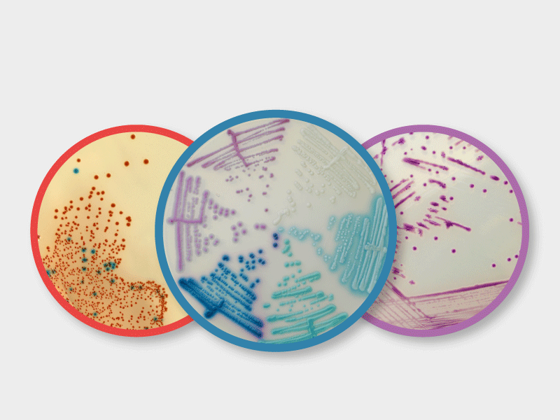 臨床科瑪嘉酵素呈色培養基